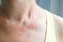 27-derma-9