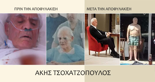 27-akis