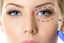06-blefaroplastiki-9