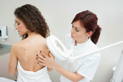 melanoma-simadia-9