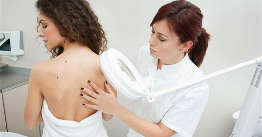 melanoma simadia