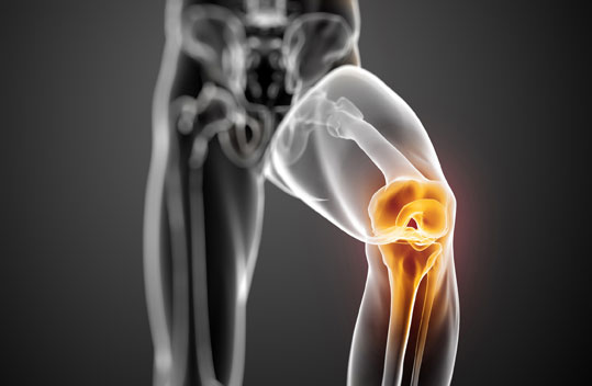 29-arthritida