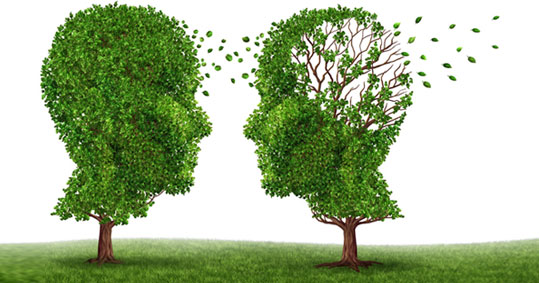 09-alzheimer