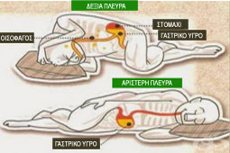 15-ypnos-9