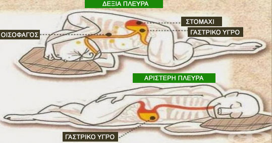 15-ypnos