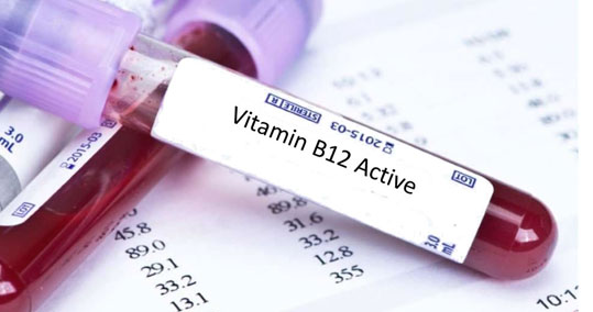 12-b12