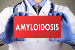 05-amiloeidosi-9