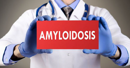 05-amiloeidosi