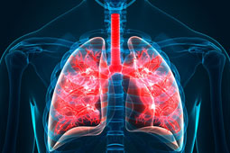 22-mesolithioma-9