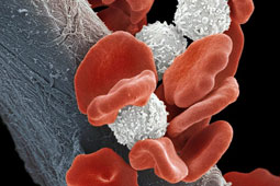 02-lefhemia-9