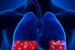 27-pneumones-9