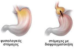 30-diafragma-9