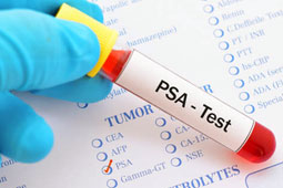 13-psa-9