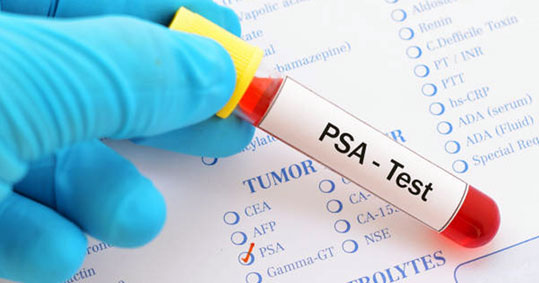 13-psa