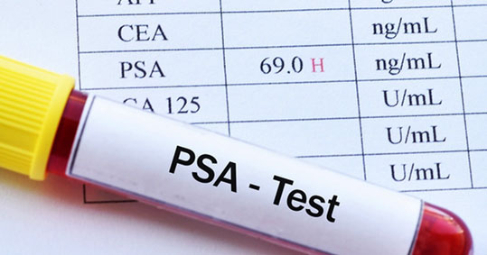 30-psa