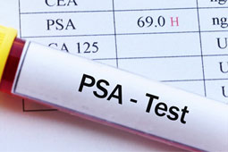 30 psa-9