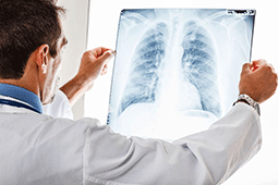 17-pneumonia-9
