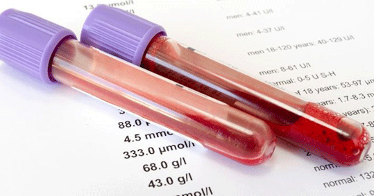 13-test