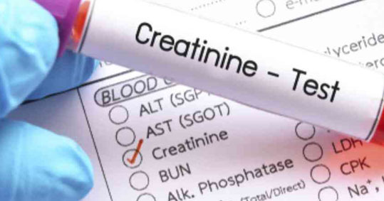 12-creatinine